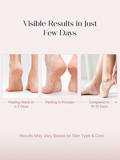 Glycolic Acid Foot Peeling Mask